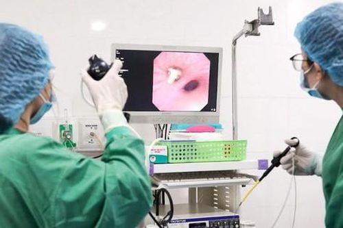 Bài học cảnh giác từ ca phẫu thuật gắp xương heo gây tắc phế quản bệnh nhân 57 tuổi