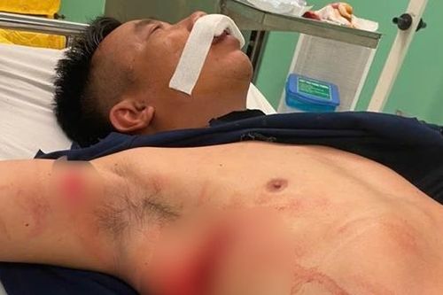 Bắt đối tượng hung hãn gây thương tích nặng cho cán bộ Công an