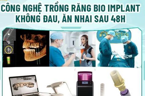 Trải nghiệm công nghệ trồng răng không đau với nha khoa Delia
