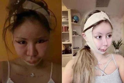 Chi 14 tỷ cho 200 ca PTTM, cô gái hối hận nhìn lại quá khứ