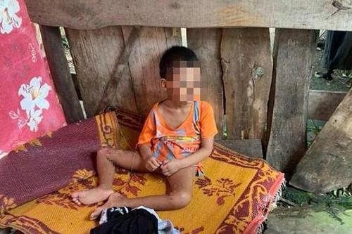 Nghệ An: Bé trai 5 tuổi gãy chân nghi bị gia đình ngược đãi