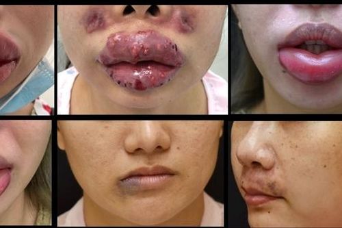 Các cơ sở 'lấn sân' là thách thức lớn trong việc đảm bảo an toàn thẩm mỹ