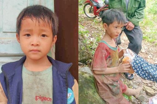 Bé trai lạc trong rừng 5 ngày sụt 4kg, bố mẹ thoạt nhìn không nhận ra con