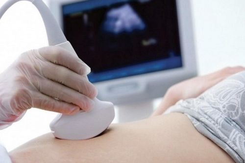 Người phụ nữ Hà Nội bất ngờ khi biết đang mang thai 32 tuần