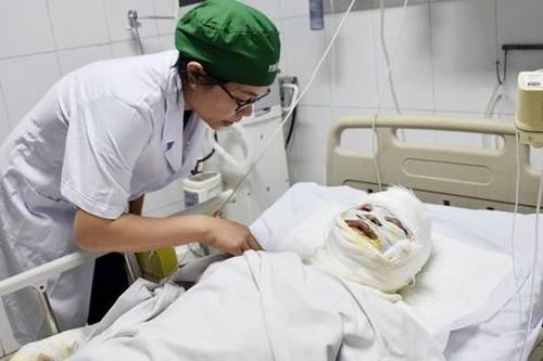 Thông tin sức khỏe 2 cán bộ bị thương nặng khi làm nhiệm vụ chữa cháy rừng