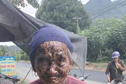 Nhà thầu 'xin rút kinh nghiệm' sau vụ phun nhựa đường vào mặt cụ bà