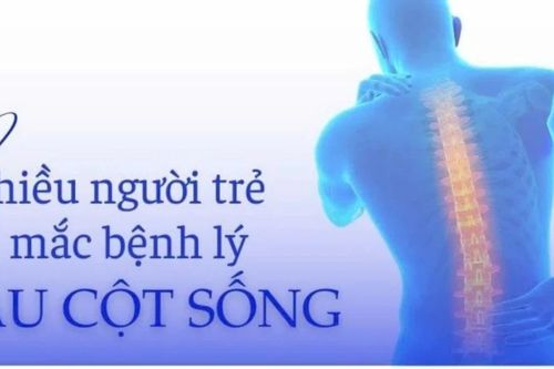 Nhiều người trẻ mắc bệnh lý đau cột sống