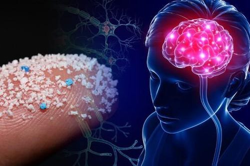 Sốc: Hạt vi nhựa ngày càng xâm lấn vào não bộ của con người càng nhiều, chiếm 0,5% não bộ