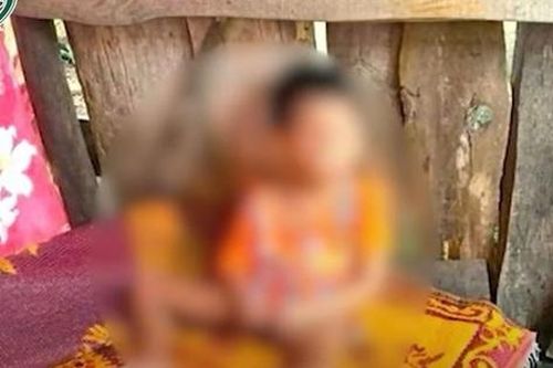 Xót xa bé trai bị bỏ ở lán với vết thương nặng, xã yêu cầu người mẹ có trách nhiệm với con