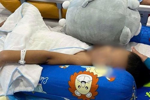 Bé trai bị 'bỏ rơi' đến hoại tử xương cụt: Tiếng kêu ám ảnh vị trưởng làng 'Ông ơi, cứu cháu với'