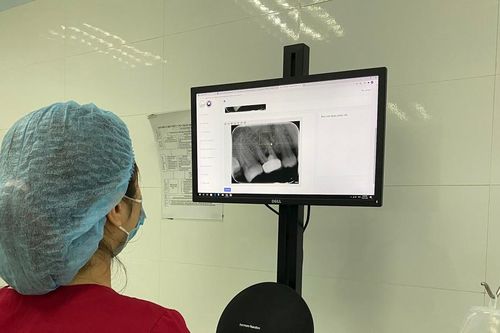 Chẩn đoán sớm bệnh nhờ AI