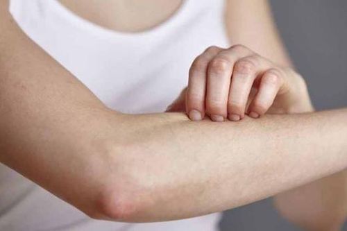 Vì sao sau khi bị muỗi đốt càng gãi càng ngứa?