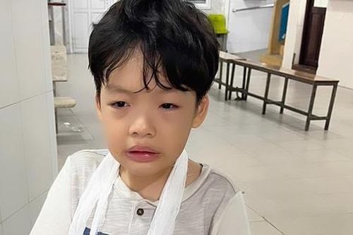 Con trai Dương Cẩm Lynh gặp sự cố gãy tay