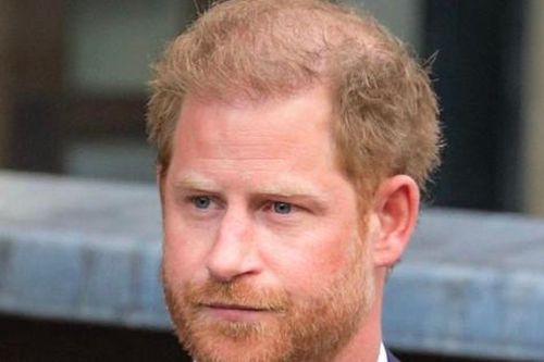 Điểm bất thường của Harry