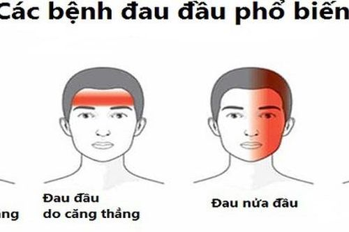 6 loại thực phẩm hạn chế đau nửa đầu hiệu quả