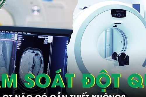 Chụp cắt lớp vi tính sọ não tầm soát đột quỵ có cần thiết?
