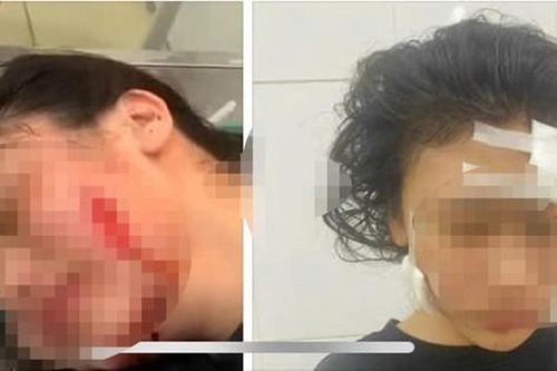 Mẹ nợ tiền, con gái bị rạch mặt