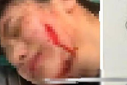 Thanh Hóa: Điều tra vụ mẹ nợ tiền, con gái bị rạch mặt
