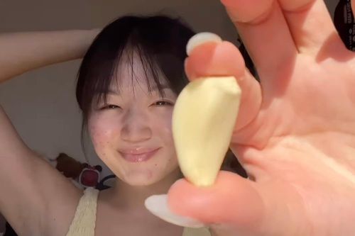 Thực hư trào lưu trị mụn bằng tỏi trên TikTok