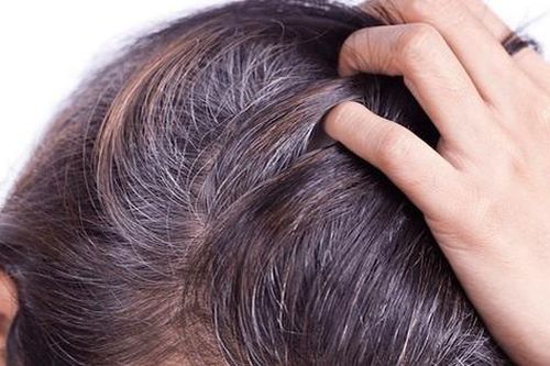 Tóc bạc sớm do đâu, khắc phục như thế nào?