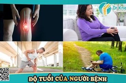 Nguyên nhân thoái hóa khớp gối – phòng ngừa thoái hóa khớp gối