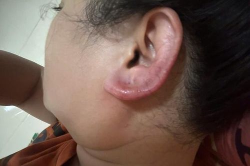 Vụ người phụ nữ nhập viện khi làm đẹp tại cơ sở thẩm mỹ: Công an vào cuộc làm rõ