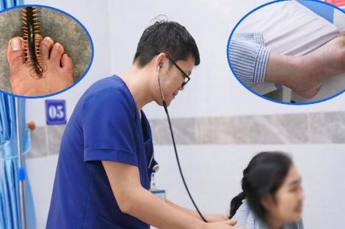 Nhiều người nhập viện do rết cắn