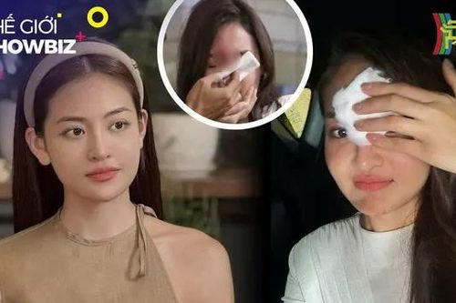 Diễn viên Thùy Anh bị cắt vai, ai đúng ai sai?
