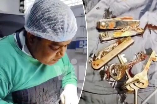 Nam thanh niên nuốt cả dao lẫn bấm móng tay, may mắn sống sót