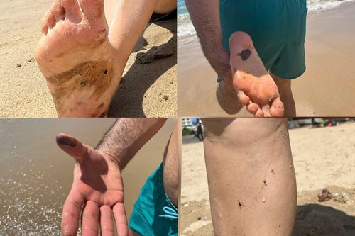 Du khách bị dầu vón cục dính đầy người, Ban quản lý Vịnh Nha Trang lên tiếng