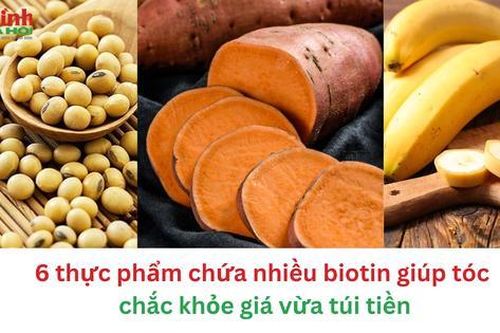 6 thực phẩm chứa nhiều biotin giúp tóc đẹp chắc khỏe lại rẻ tiền