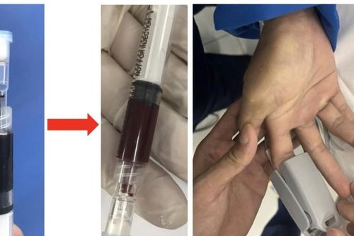 Bác sĩ tại TPHCM không còn phải lo tìm thuốc hiếm trong ca trực cấp cứu