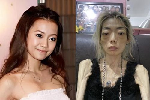 Nữ người mẫu hủy hoại dung nhan, chỉ còn da bọc xương vì lời chê bai của chồng tỷ phú