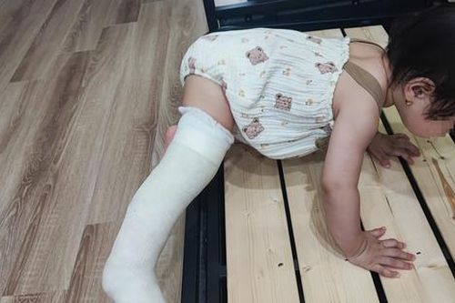 Bé gái 13 tháng tuổi gãy chân sau khi đi học về, nhà trường chối bỏ trách nhiệm