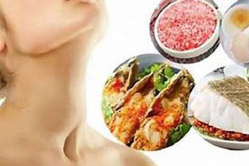 Bị bướu cổ nên ăn gì, kiêng gì?