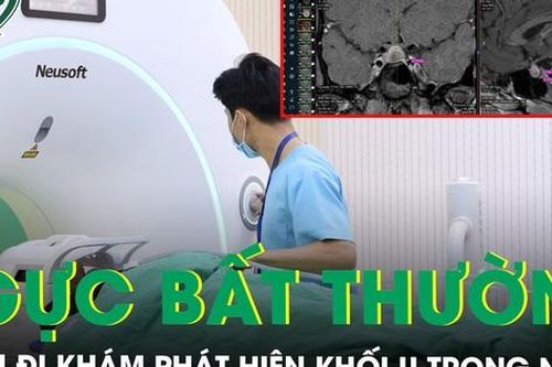 Ngực phát triển bất thường, bé gái đi khám phát hiện khối u trong não