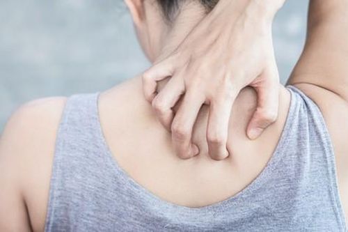 Khi nào ngứa da là dấu hiệu của bệnh ung thư?