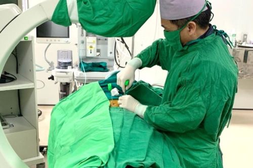 Bơm xi măng sinh học qua da: Phương pháp hiệu quả điều trị cho bệnh nhân xẹp đốt sống