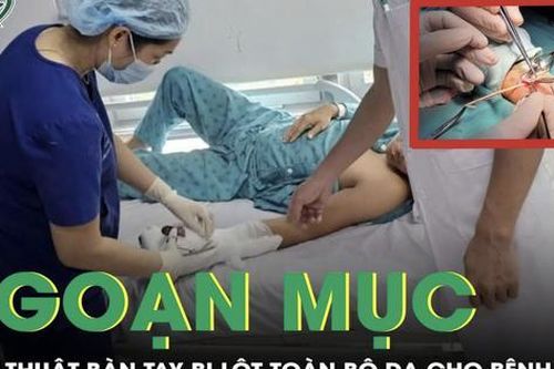 Cứu thành công bàn tay bị lột toàn bộ da cho nam thanh niên 30 tuổi