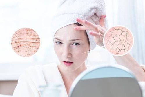 Da khô và thô ráp khắc phục thế nào?