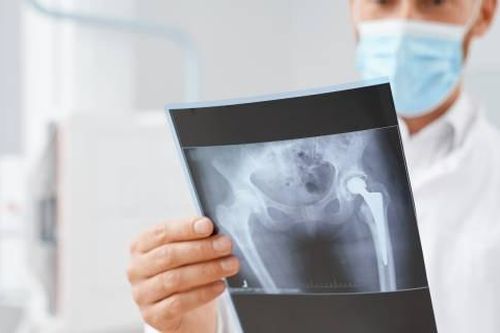 Phim chụp chân của bệnh nhân khiến bác sĩ sửng sốt