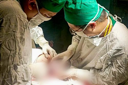 Mất điện vì bão số 3 đổ bộ, bác sĩ bật máy phát, mổ cấp cứu cho sản phụ 19 tuổi