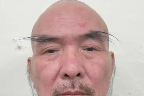Hà Nội: Tạm giam đối tượng giả thương binh, chặn xe cứu thương