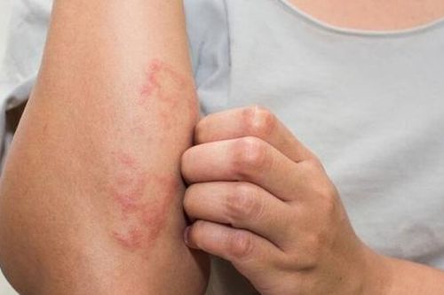 5 bệnh thường gặp sau mưa bão, biết những điều này để an toàn cho cả nhà