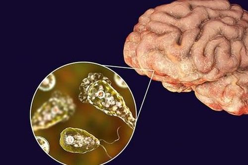 Amip ăn não: Nguyên nhân, biểu hiện, cách điều trị và phòng bệnh