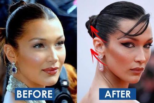 FaceTape: Căng cơ mặt bằng băng keo dính 'thống trị' giới làm đẹp TikTok