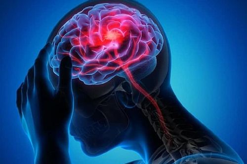 Câu hỏi thường gặp liên quan đến áp xe não