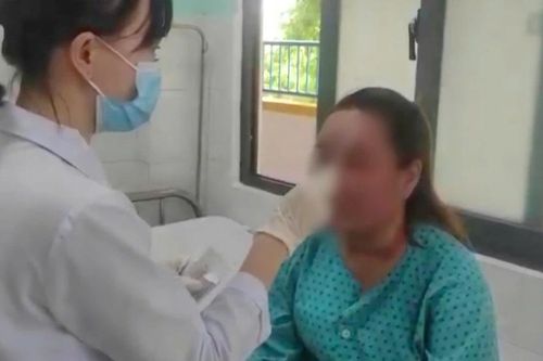 Tự peel da tại nhà, một phụ nữ 28 tuổi nhập viện