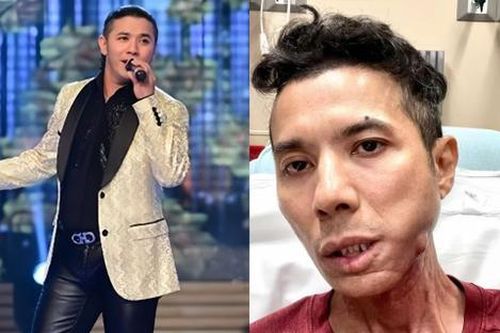 'Ca sĩ Kasim Hoàng Vũ bệnh nặng hơn những gì chúng ta biết'