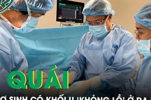 Bé trai sơ sinh đầu tiên tại Việt Nam có khối u quái 'khổng lồ' ở dạ dày hiếm gặp